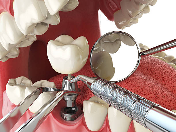 Best Emergency Dental Services for Seniors in Cowan, TN